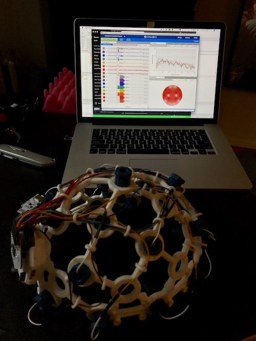 the complete EEG setup